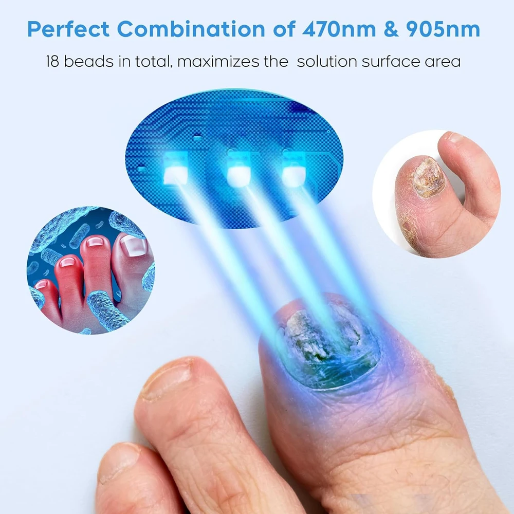 Nail Fungus Laser Treatment Device Repair Toenail Fingernail Fungus Treat Onychomycosis Therapy Cure Machine Effectively Remove