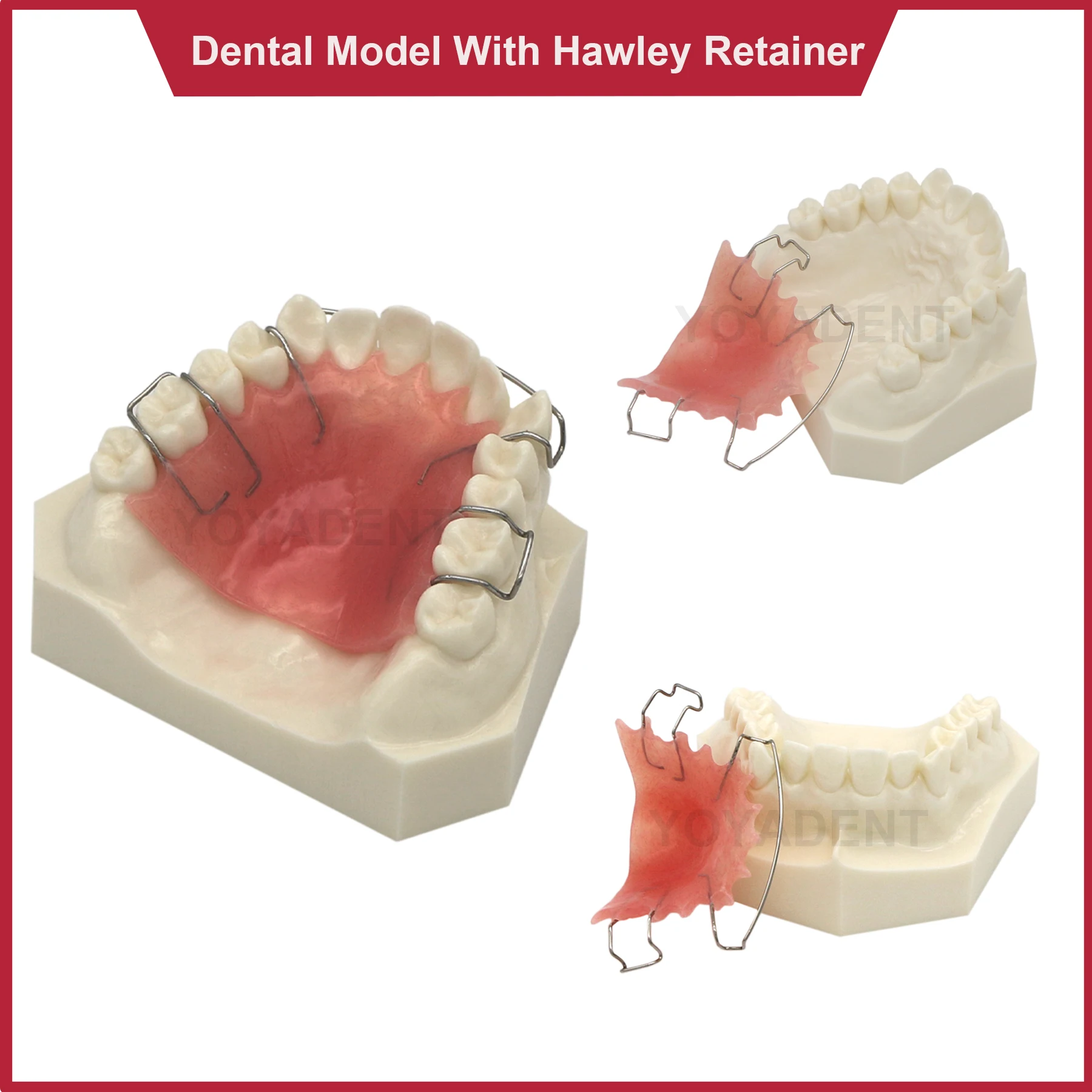Dental Tooth Model Resin Hawley Retainer Model Orthodontics Treatment Bionator Removable For Patient Education Demo Accessories
