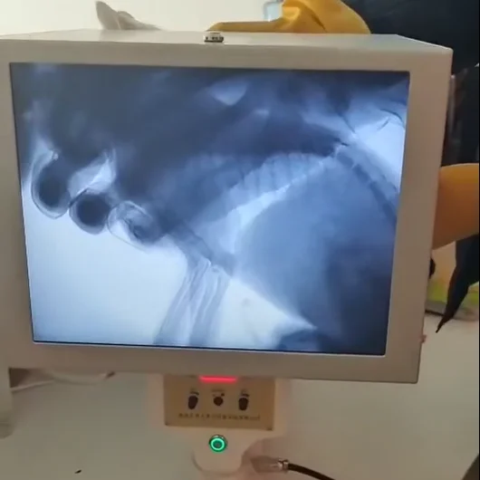 Vet Portable High Definition X Ray Pet Dog Cat Fluoroscopy For traumatology Veterinary X Ray Machine