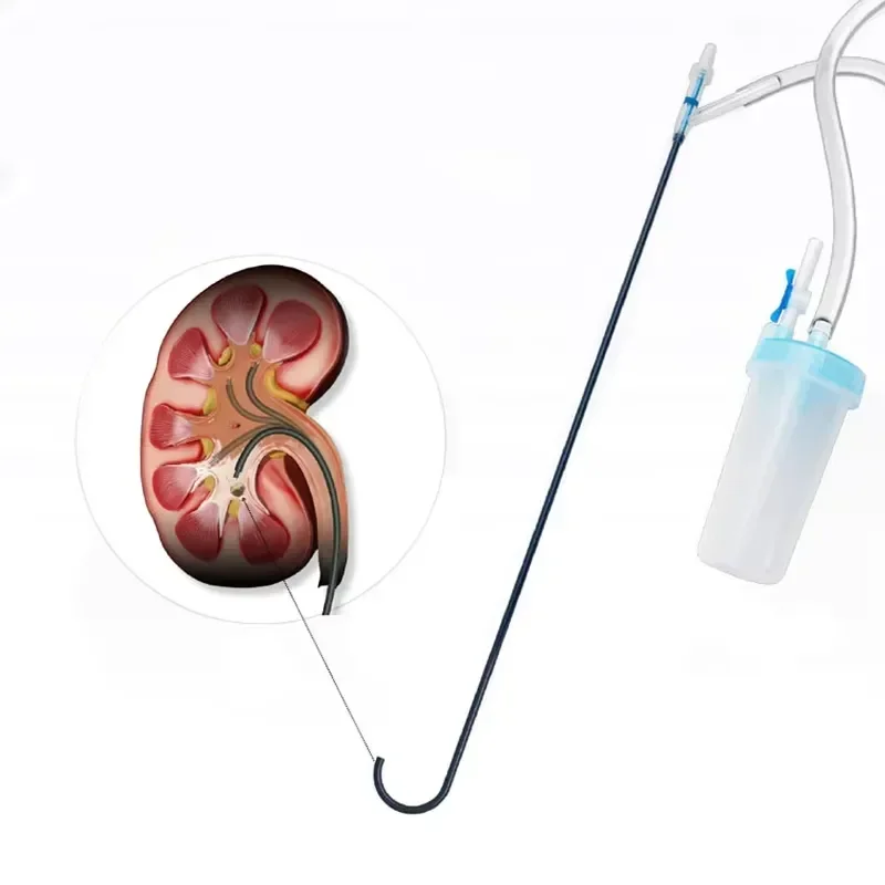 Disposable Flexible Navigable Suction Ureteral Access Sheath with Hydrophilic Coated Shaft and Stone Collection Bottle for