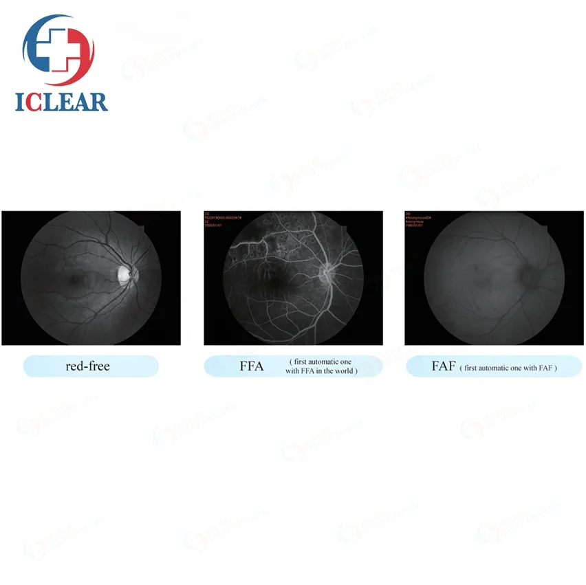 China 3D Hr Digital Automatic Non-Mydriatic Fundus Camera with FFA/FAF