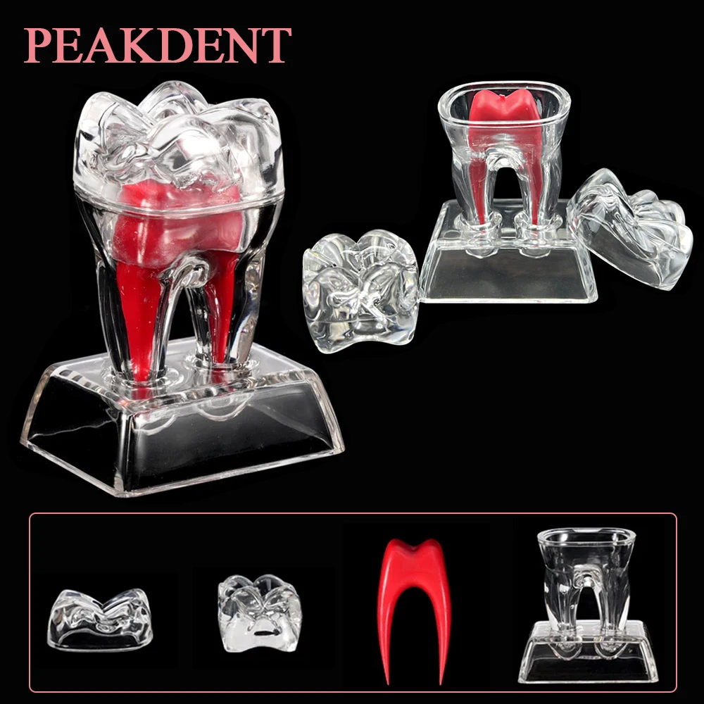 

Стоматологическая анатомическая модель Молярная модель зуба Разделенная обучающая демонстрационная модель Съемная модель разложения одного зуба