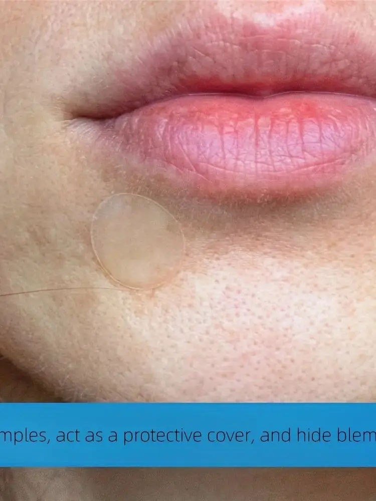 360 قطعة من ملصق حب الشباب الشفاف المستدير، مقاوم للماء وجيد التهوية، للاستخدام اليومي للوجه، بشرة الوجه