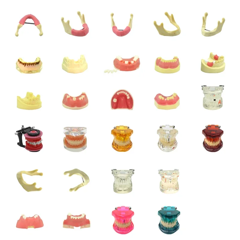 Multiple Types Dental Model Teeth Dental Orthodontic Teaching Teeth Model Typodont Teeth Model Dentist Material