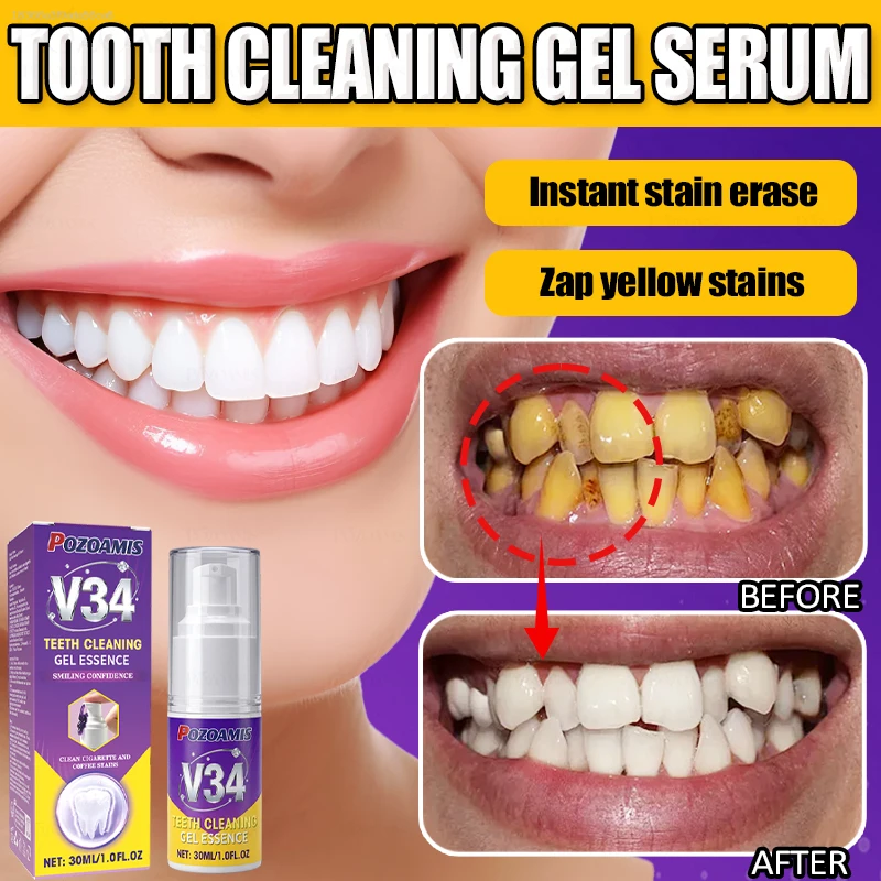 Effectively removes tooth stains, restoring the teeth's natural, clean, and bright luster.
