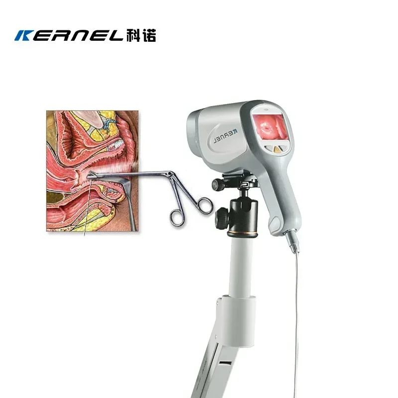 Kernel HD digital colposcope hd video colposcope vaginal camera for vagina examination gyneology women health colposcopy