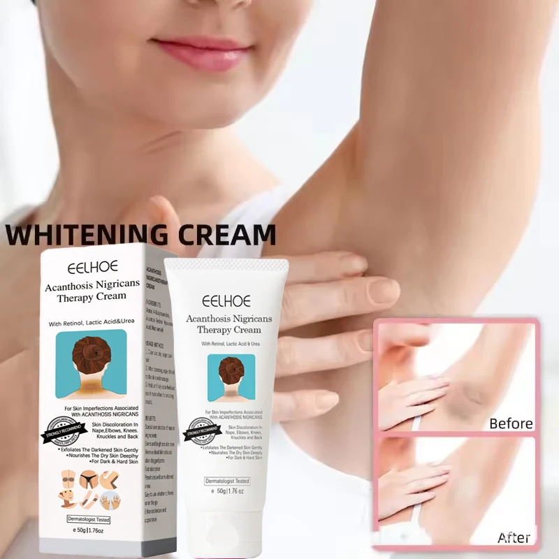 

Whitening Cream For Dark Skin Armpit Thigh Inner Joint Lightening Intimate Area Underarm Body Care Private Parts Brighten Lotion