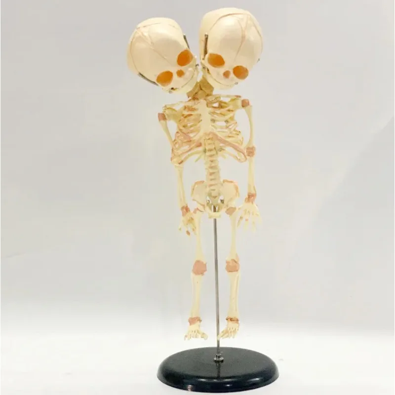 

35CM Human Double Headed Baby Skull Skeleton Anatomy Brain Display Learning Anatomy Model Halloween Accessories Home Decoration