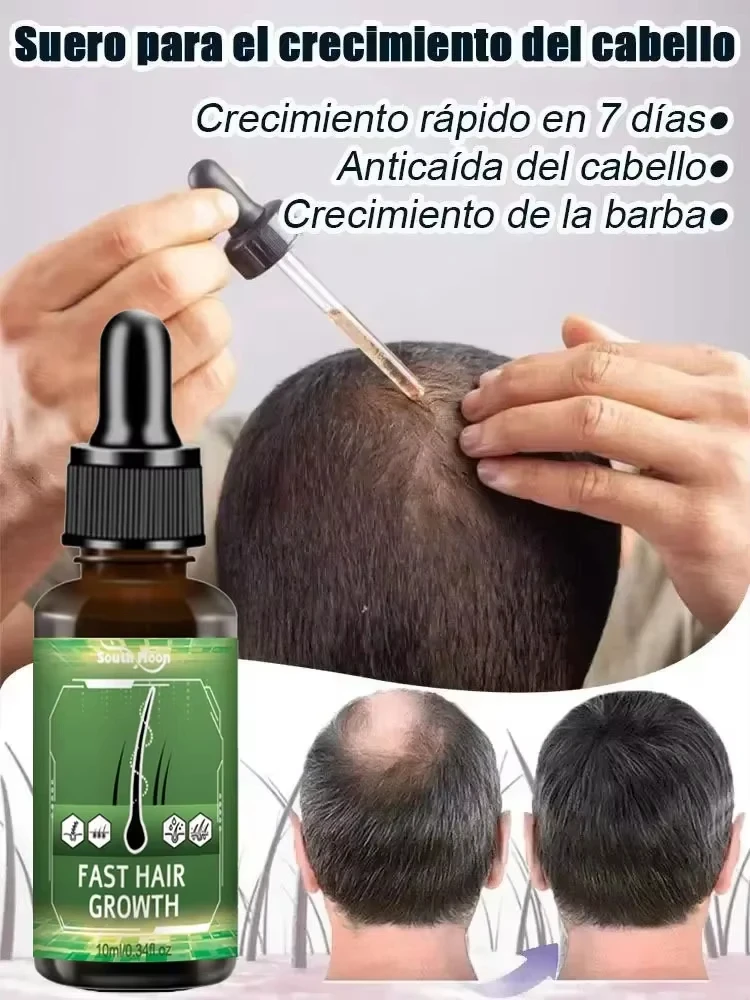 

Get more hair, say goodbye to baldness and thick hair. sell like hot cakes