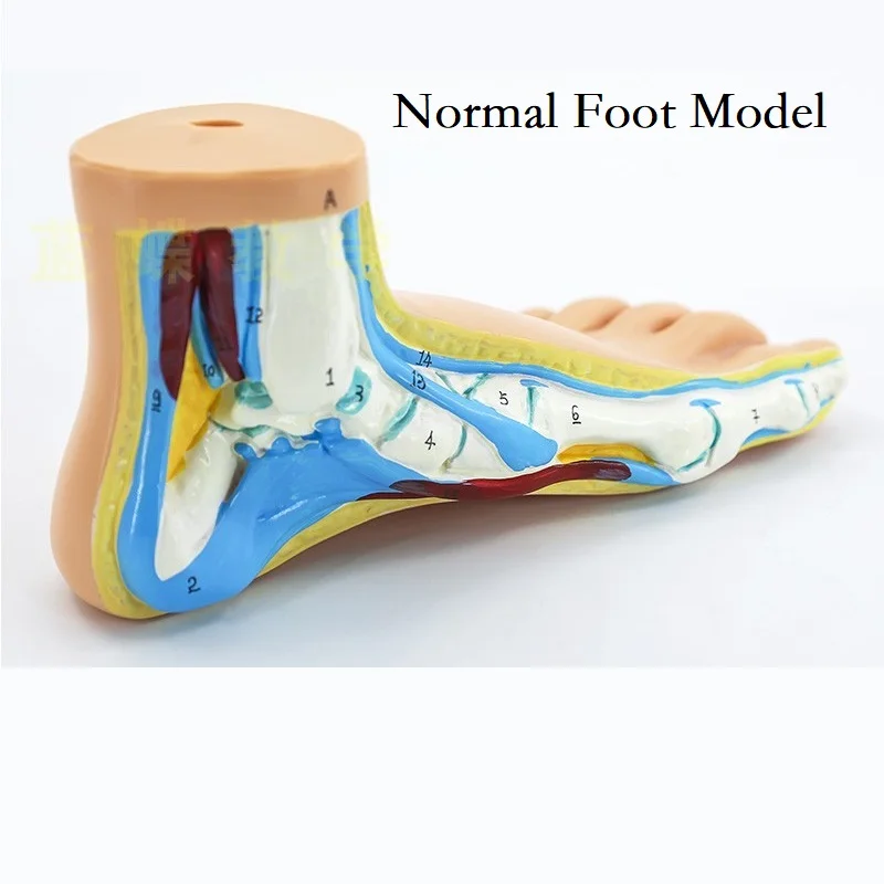 Normal, Flat, Arched Foot Model , Cavus, Foot Joint And Bone Skeleton Massage Foot Model Referance