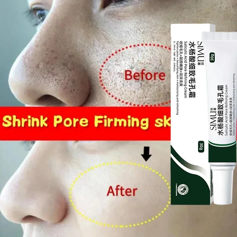 

Salicylic Acid Pores Shrink Refining Cream Treatments Large Open Pore Remove Black Dots Blackhead Acne Marks Face Skin Products