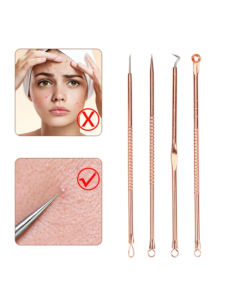 4 pièces d'outils pour éliminer l'acné, les points noirs, les comédons, les boutons, les imperfections, soin de la peau, beauté féminine, traitement de l'acné, nettoyant pour les pores, crochet à