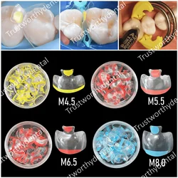 Dental Clear Matrix Posterior Fits Bioclear Transparent BT Matrices Molar Composite Class Restorative 4.5/5.5/6.5/8.0 0.038mm