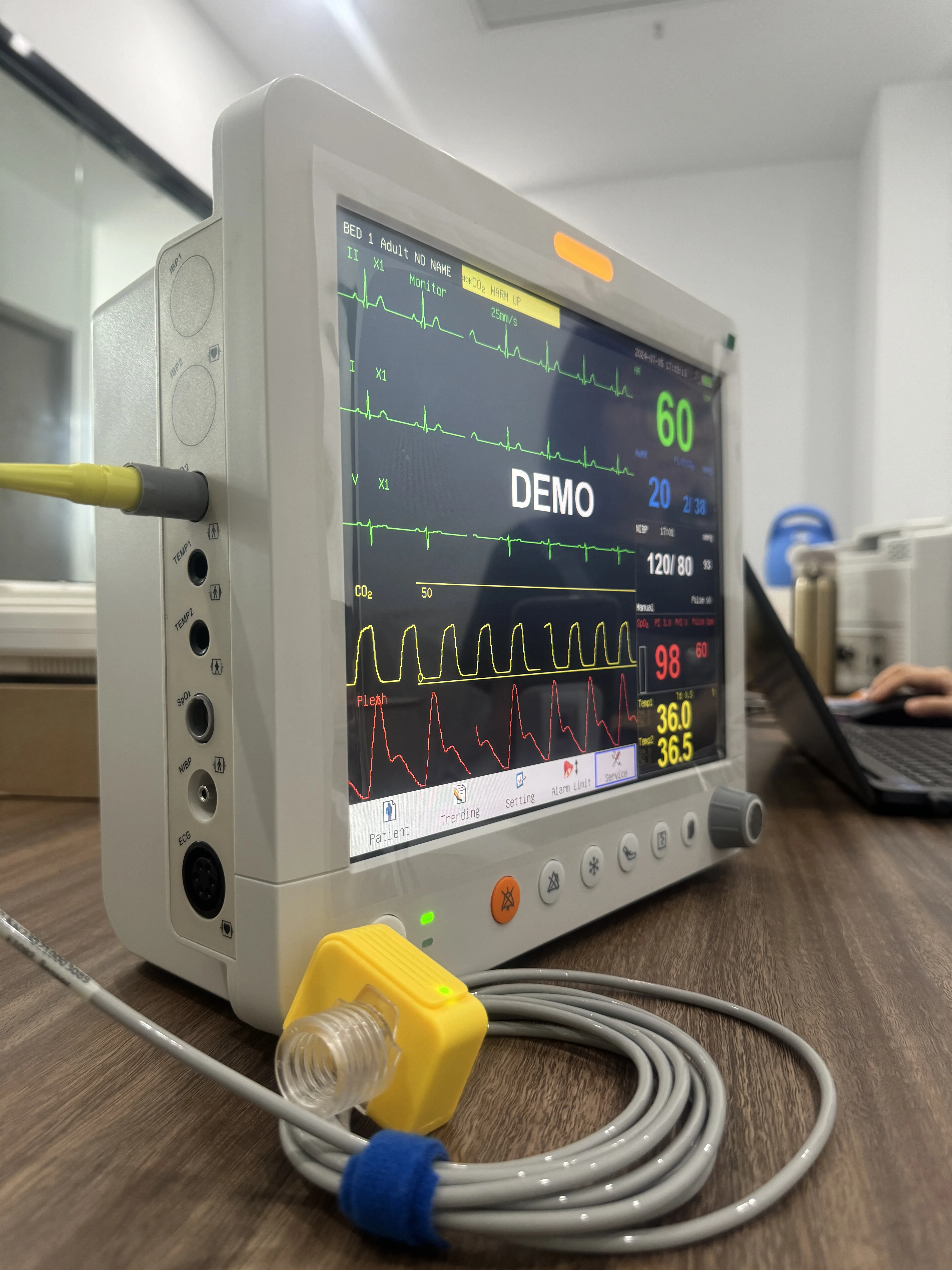 Veterinary 15inch Multiparameter Animal Patient Monitor with Capnograph ETCO2 IBP Touch Screen Bedside Monitor