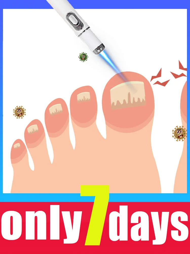 

Новая технология 2025 года. Скажи добро пожаловать на онихомикоз с лазерной технологией изменения жизни.