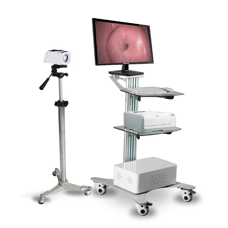 Digital Video Colposcope/Colposcopy for Sale/Low price Colposcope cheap