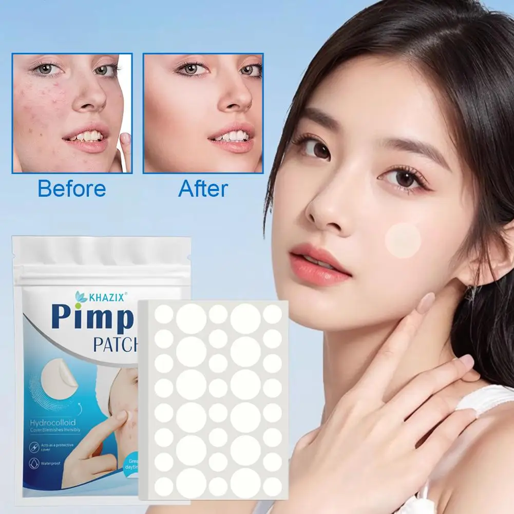 Remendo transparente para acne, corretivo invisível, limpeza suave, comedões, cravos, ferramentas faciais, pele fechada, cosméticos wo h1a9