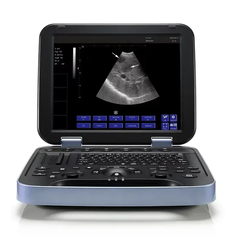 Portable PU-VDL152A Veterinary B-ULTRASOUND for Hospital Use Ultrasonic Detector for Pet Animals