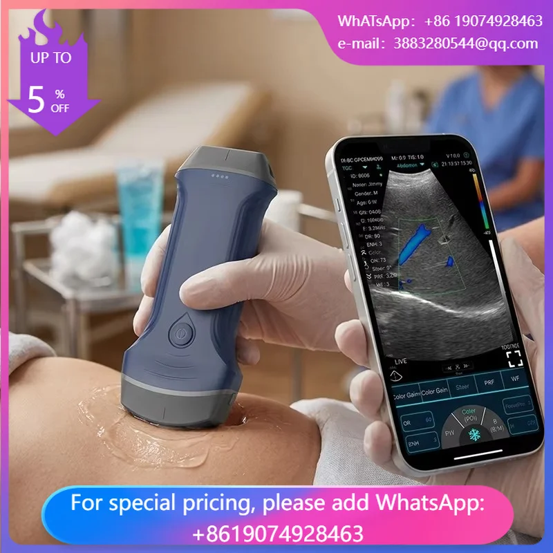 Wireless Dual Head Convex+Linear Probe Scanner Handheld Portable Color Doppler Ultrasound Probe