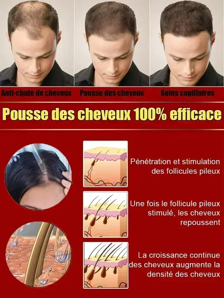 2025 biotina óleo de crescimento rápido do cabelo soro de recrescimento do cabelo tratamento de desbaste do cabelo líquido de crescimento do cabelo anti-perda de cabelo para mulheres e homens