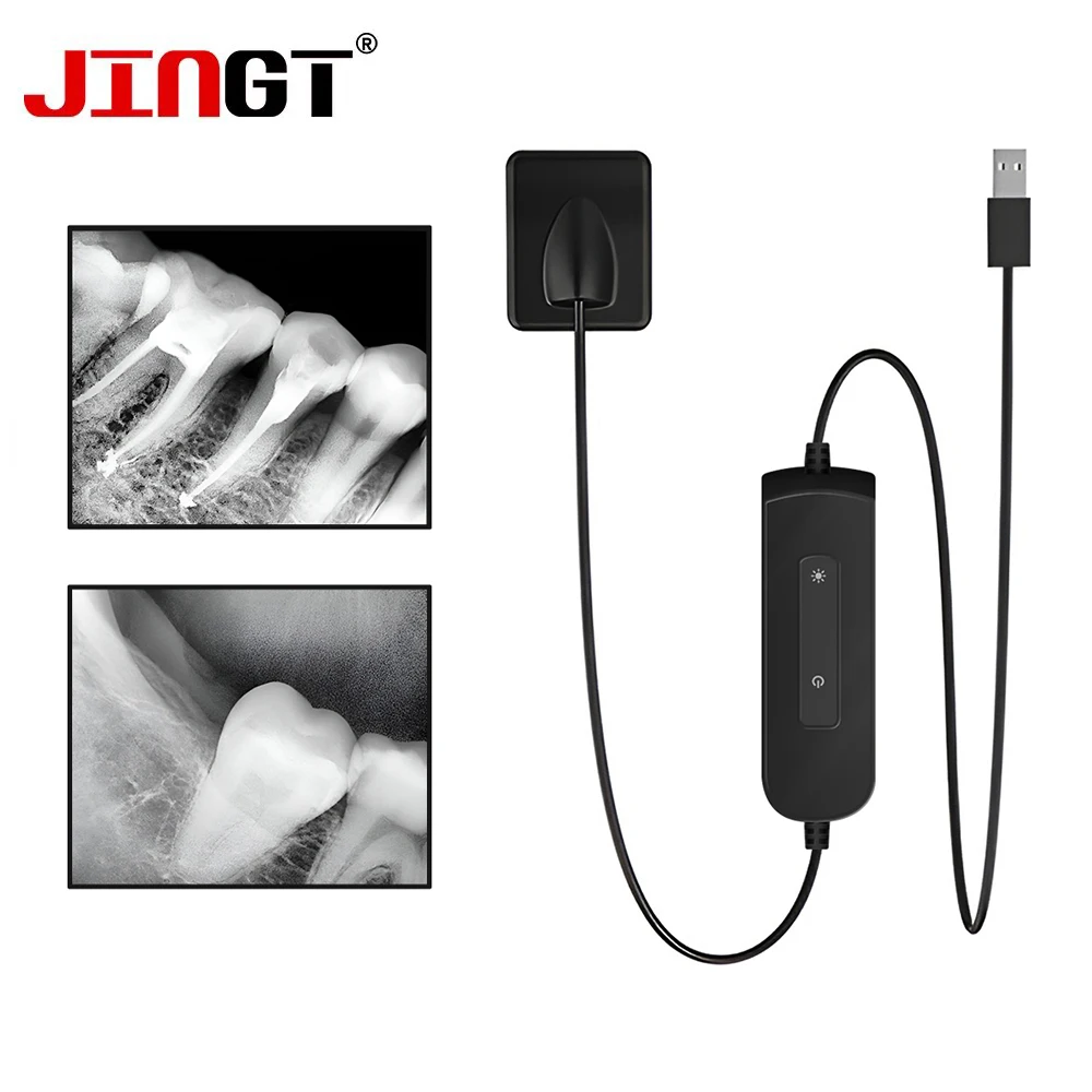 JINGT Sensore dentale Raggio X Sistema digitale intraorale digitale Rx ad alta frequenza Immagine HD Sensore digitale dentale Radiovisografo