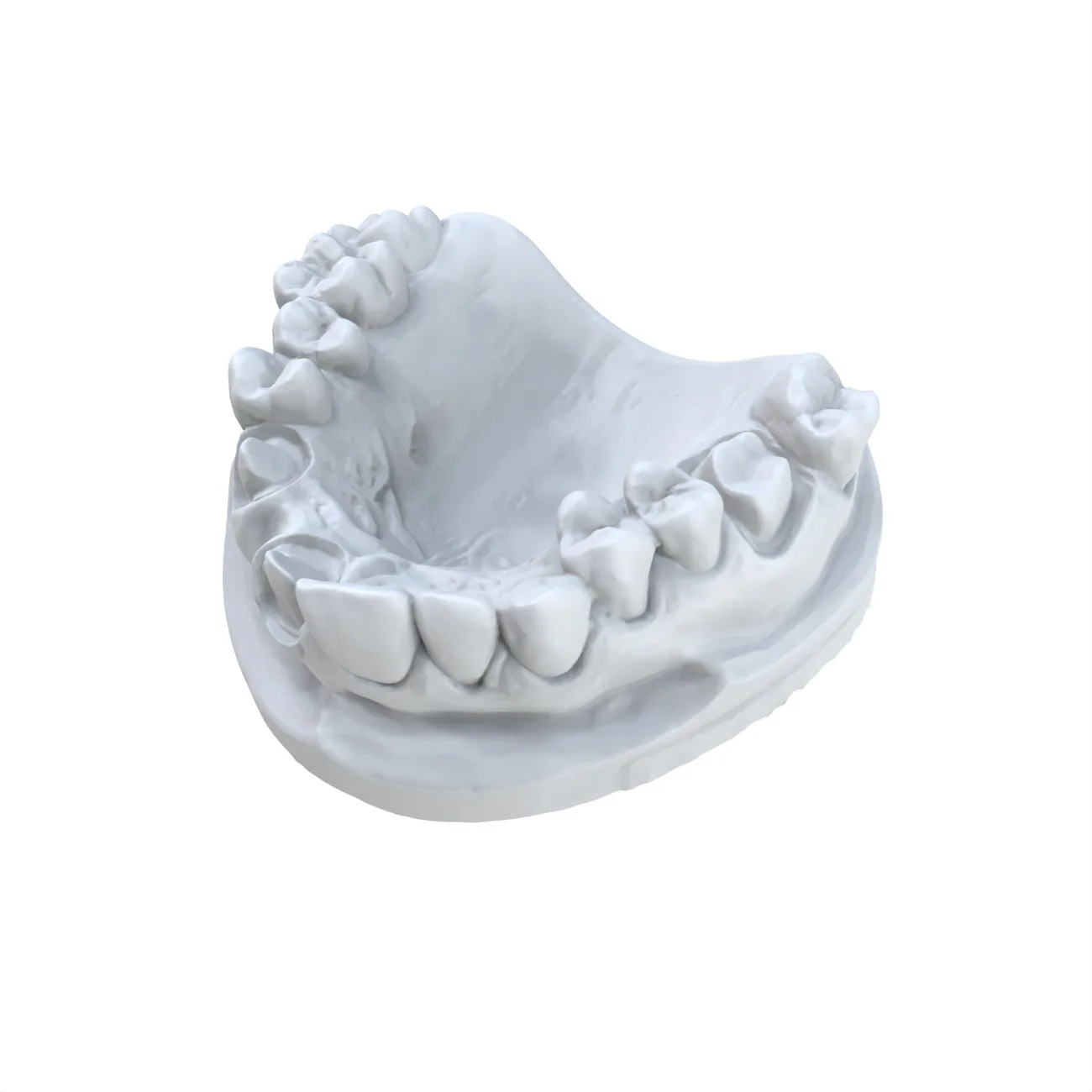 1 шт. стоматологическая модель – обзор и цена 3D Printing Dental