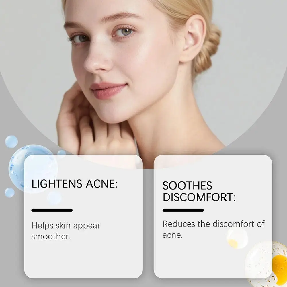 80pcs Facial acne patch Acne Blackheads Closed Comedones Improve Acne-prone Skin Gentle Formula Suitable For Daily Use