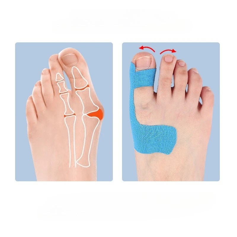 10 ชิ้นเทป Hallux Valgus Big Toe Corrector เทปกีฬากันน้ําเทปป้องกัน Toe Corrector Straightener Foot Care Tool