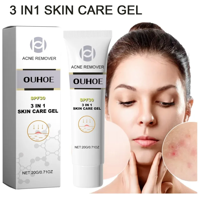 3 em 1 acne cuidados com a pele gel controle de óleo limpeza profunda clareamento acne cravos marcas hidratante suavização gel de reparação da pele