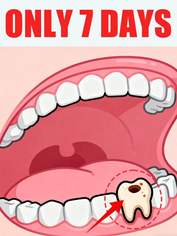 Geração-2 bolhas diz adeus às pedras intraorais em 7 dias