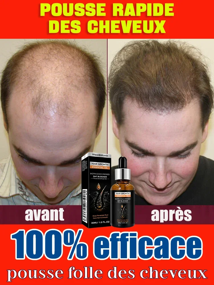 Hot selling product, 99% of buyers buy again, have more and more hair, say goodbye to baldness, thick hair