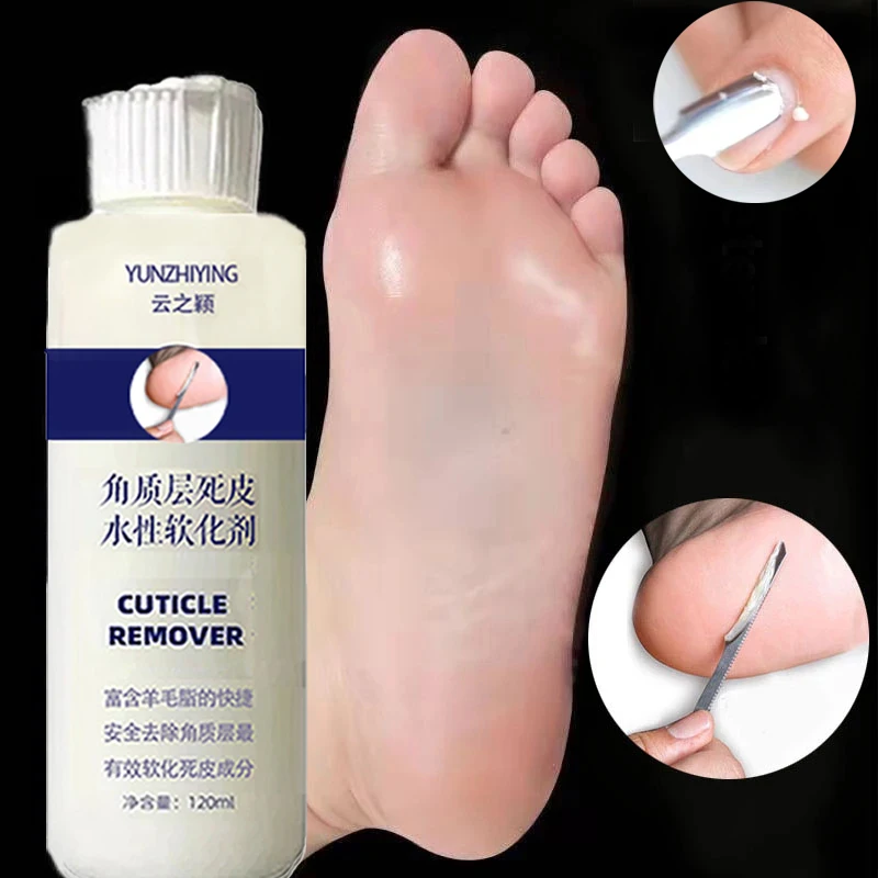 Foot Exfoliator Softener 6 Seconds Remove Dead Skin & Calluses Foot Mask Anti-Cracked Heel Enhancer Nail Pedicure 120ml