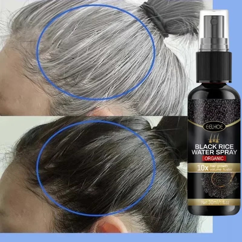 

Gray White Hair Treatment Serum Spray White To Black Natural Color Black Rice Repair Essence Anti Hair Loss Beauty Health Care