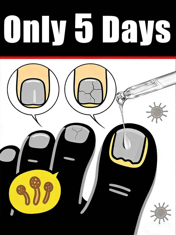 

Sᴀʏ ɢᴏᴏᴅʙʏᴇ ᴛᴏ ʀᴏᴜɢʜ ғɪɴɢᴇʀᴛɪᴘs, ʟᴏᴄᴋ ɪɴ ᴍᴏɪsᴛᴜʀᴇ ғᴏʀ ʟᴀsᴛɪɴɢ sᴏғᴛɴᴇss.