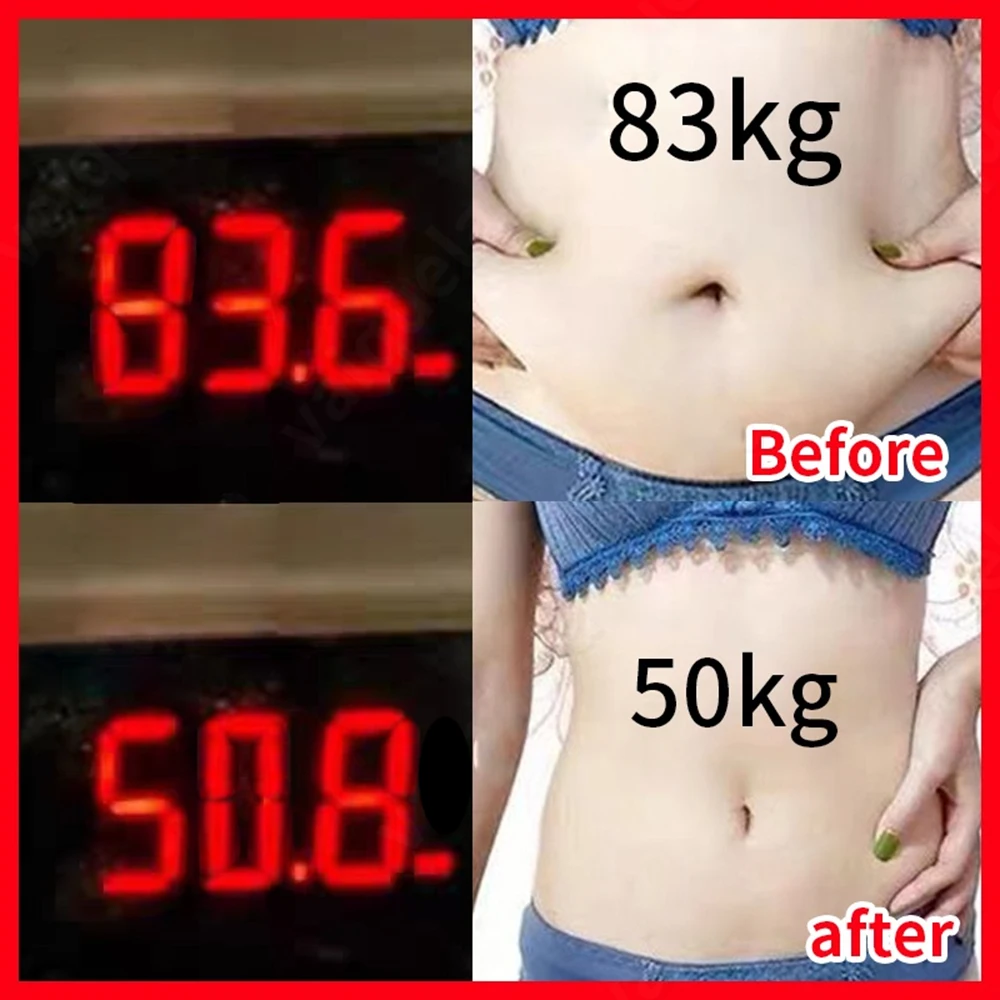 

30PCS New Navel Fat Burning Patch Improve Stomach Discomfort Belly Slimming Products Chinese Medicine Lose Weight Stickers