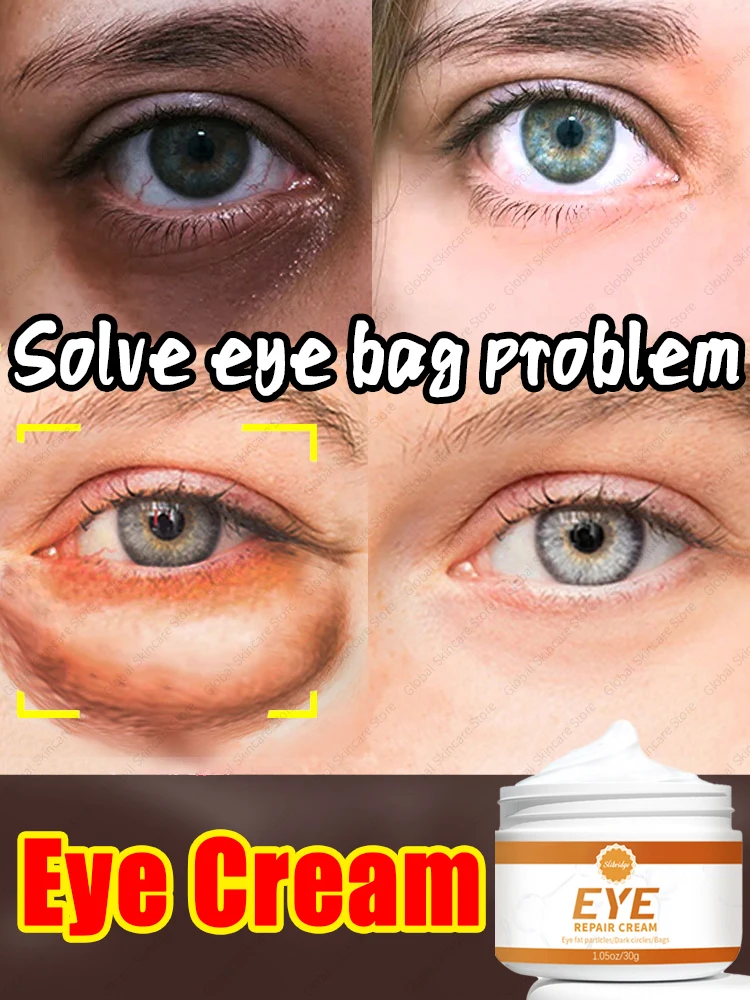 

Eye Care To Creams