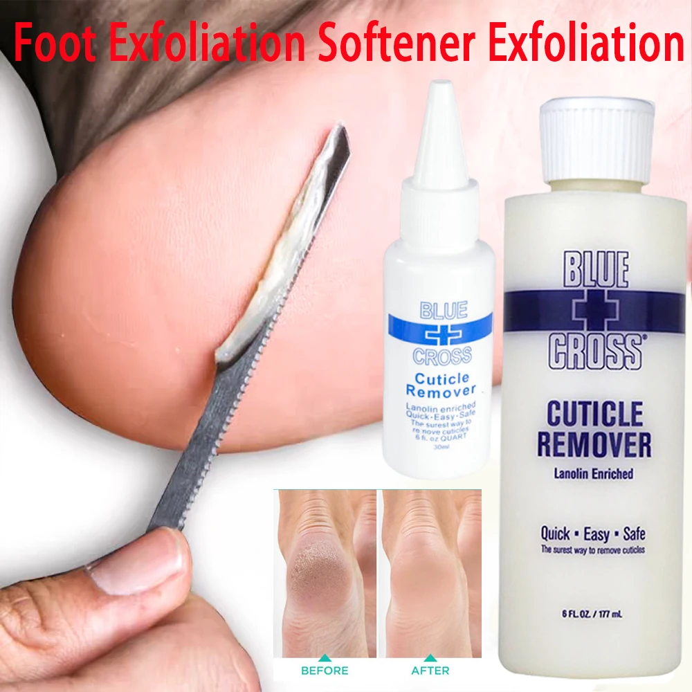 30/177/473ml Foot Exfoliation Softener Exfoliation Foots Cuticle Remove Foot Mask Pedicure Nail Enhancer Remove Dead Skin Callus
