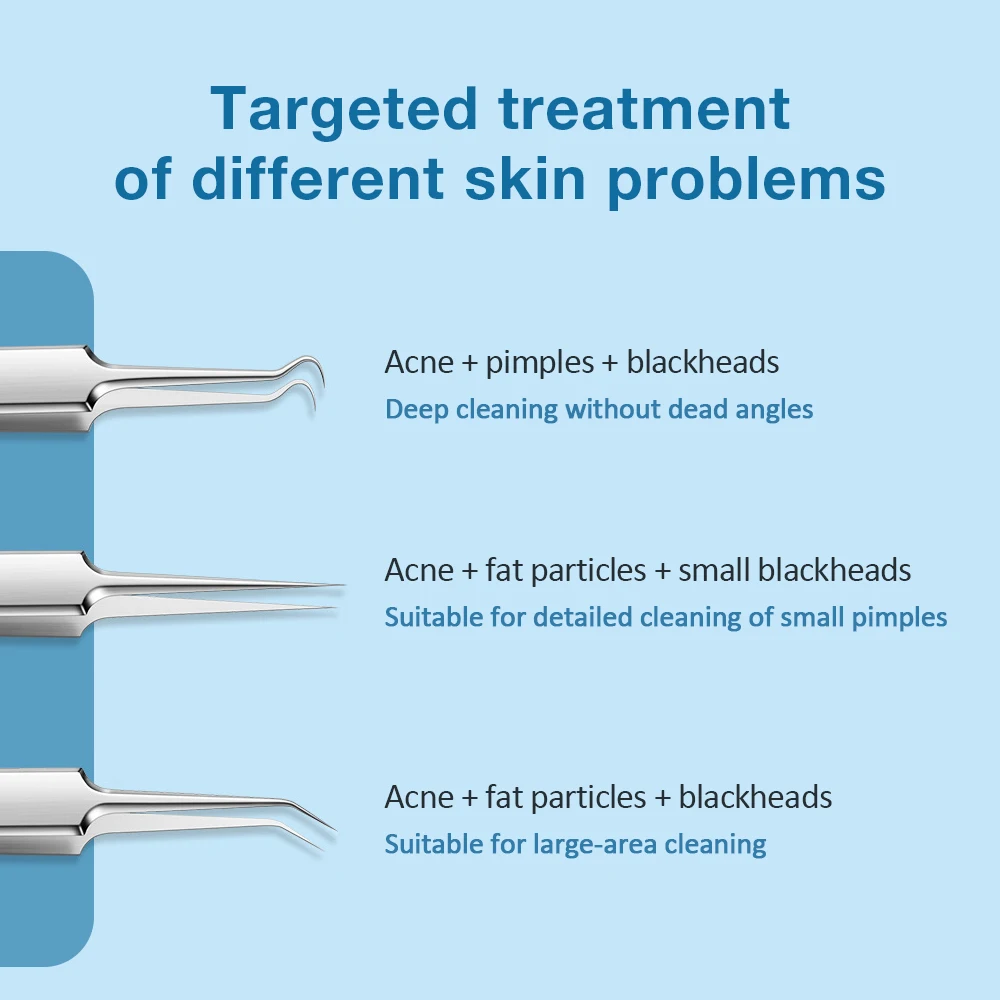 3 SZT. Ultra Cienkie Pęsety Nr 5 do Usuwania Pryszczy, Wągrów, Specjalne Narzędzie do Salonów Kosmetycznych, Skrobanie, Zamykanie Porów, Igła do Trądziku, Narzędzie do Usuwania Uszkodzeń