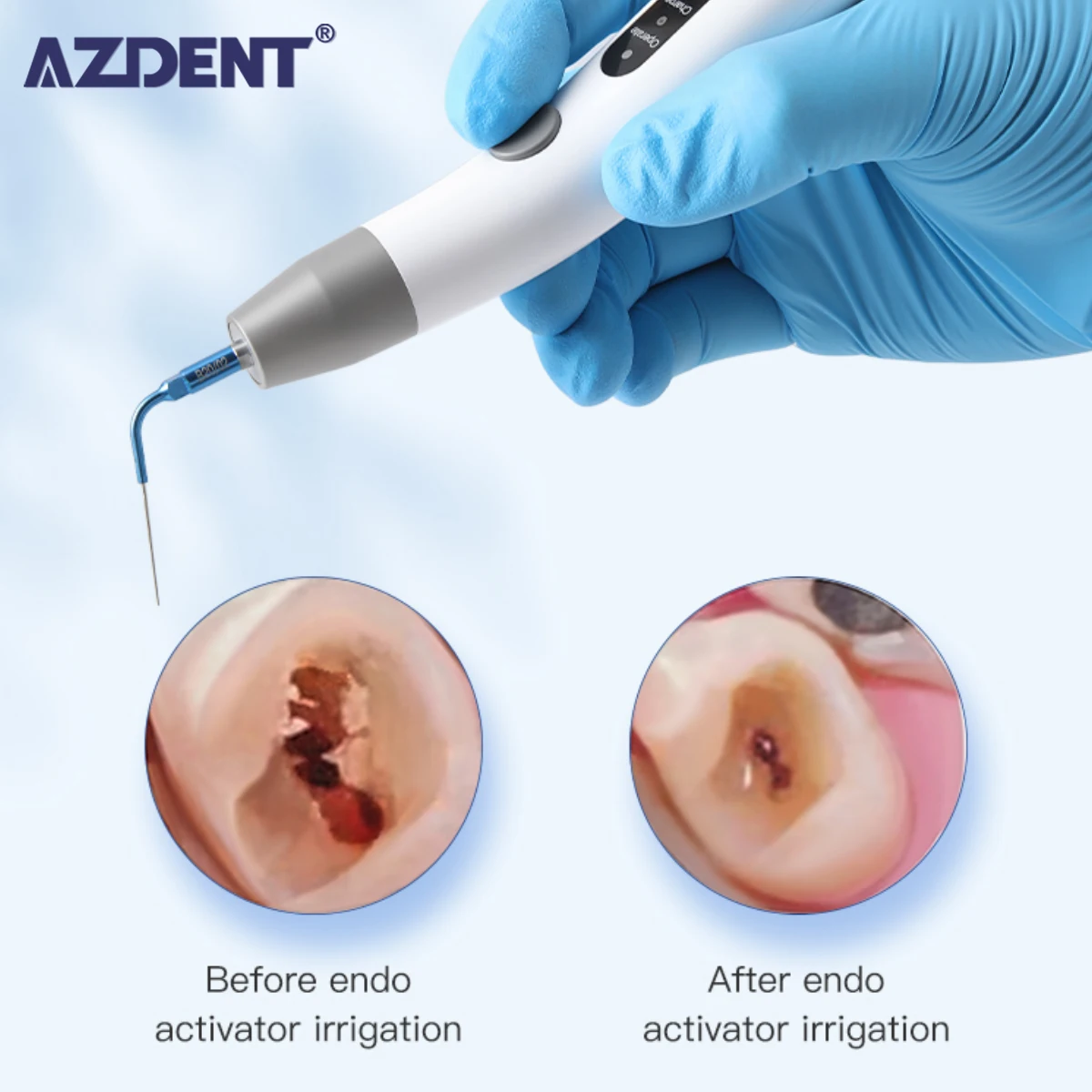 

AZEDNT Dentistry Sonic Irrigator Tips Endo Activator For Dental Instrument Root Canal Sonic Irrigator Endodontic Tools