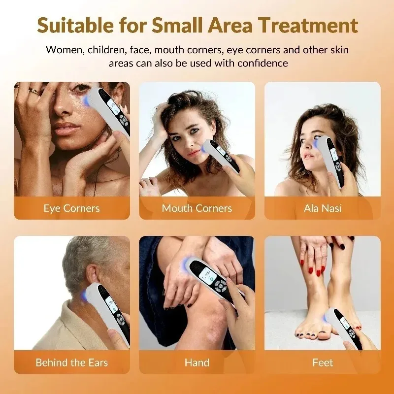 Toponechoice 308nm UVB Light Therapy Device 9 Diodes Uvb Phototherapy Device Narrow Band Home Unit Laser Led for Lichen Planus