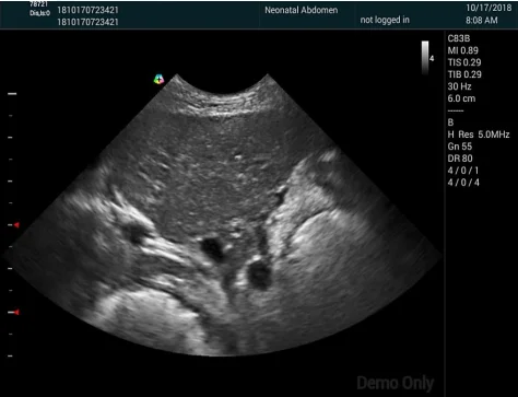 Small Animal Color Doppler Ultrasound Professional Fast Scan Veterinary Linear Array