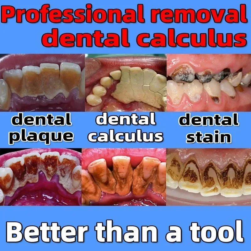 Dentifrice blanchissant pour probiotiques, élimination enzymatique de la pierre dentaire, prévention des odeurs buccales, parodontite, rafraîchit l'haleine, 2024