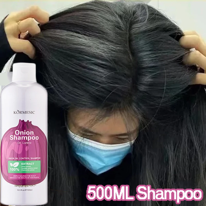 

500 мл шампунь для роста волос с луком, против выпадения волос, контроль жирности, удаление перхоти, увлажнение, питание, восстановление кожи головы, поврежденные сильные волосы