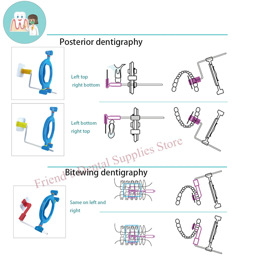 Dental röntgen feste Klammer Röntgen position ierer Dental filmtyp, Film maschine und Dental films chatz sind verfügbar, 12 teile/schachtel