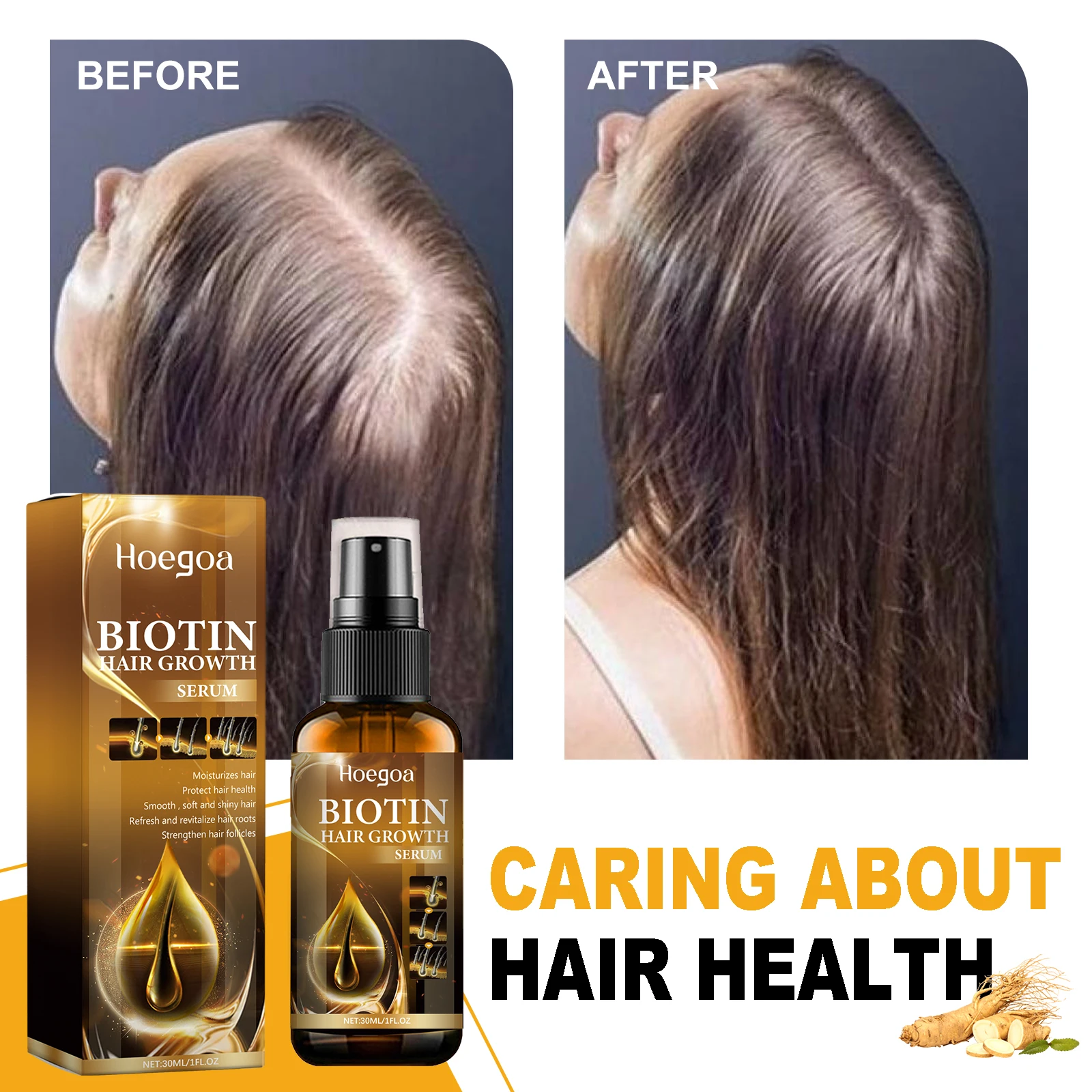 

Biotin Fast Hair Growth Serum Anti Hair Loss Products Prevent Baldness Hair Regrowth Treatment Scalp Beard Growth Spray Essence