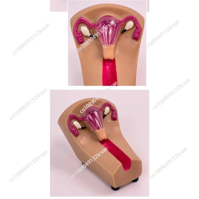 Female Intrauterine Contraceptive Guidance Training Model Uterine Genital Organ Teaching Mold Upper Ring Taking Practice