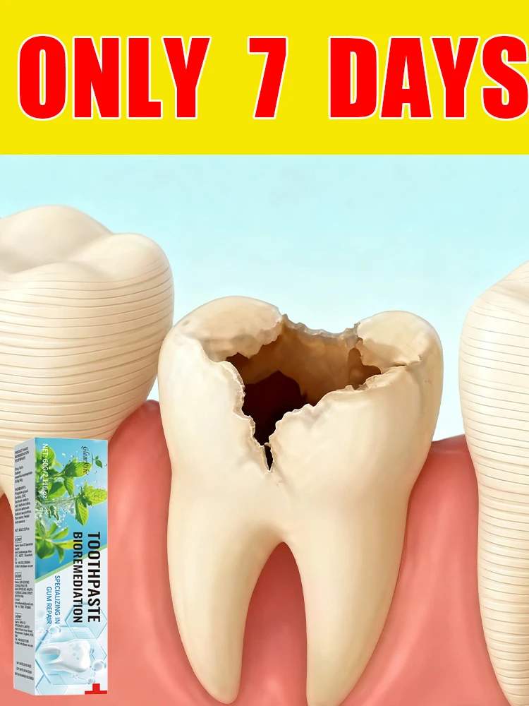 

Eᴀsɪʟʏ ʀᴇɢᴇɴᴇʀᴀᴛᴇ ɢᴜᴍs ᴀɴᴅ ᴄᴏᴠᴇʀ ᴛᴇᴇᴛʜ ɪɴ 7 ᴅᴀʏs2025