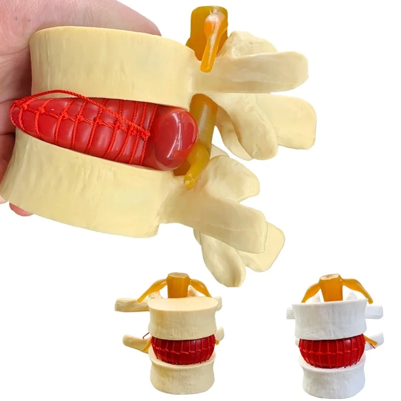 Spine Human Spine Model Full Size Demonstration Model Of Human Lumbar Intervertebral Disc Compression For Medical Teaching