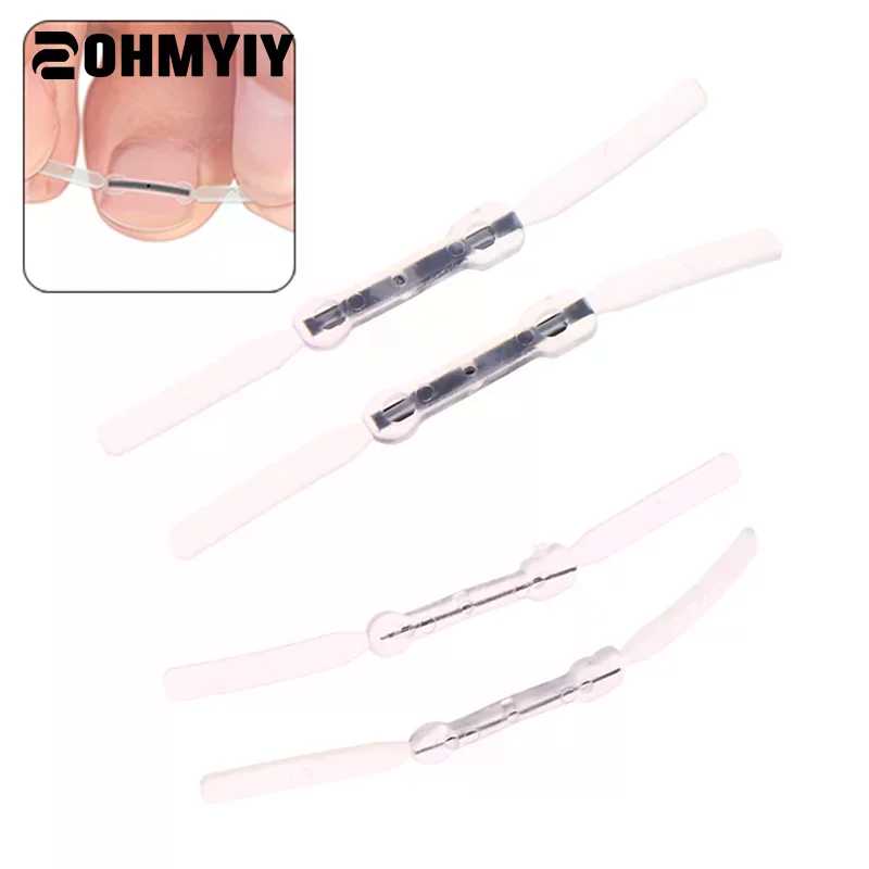 4 szt./zestaw Narzędzie do korekcji wrastających paznokci Elastyczna naklejka do leczenia wrastających paznokci Klips prostujący Paznokcie Narzędzie do pedicure