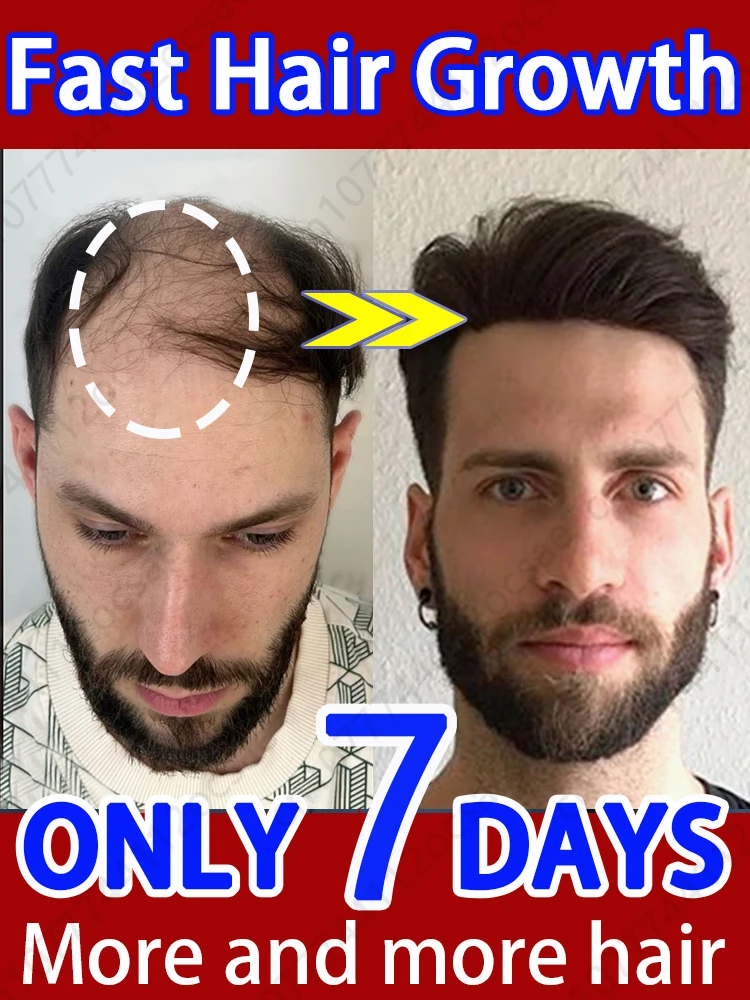 

let hair a week +10cm